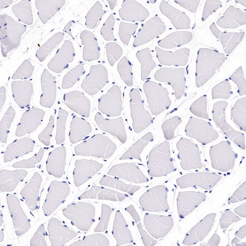 p14ARF Recombinant Rabbit mAb (S-R244)