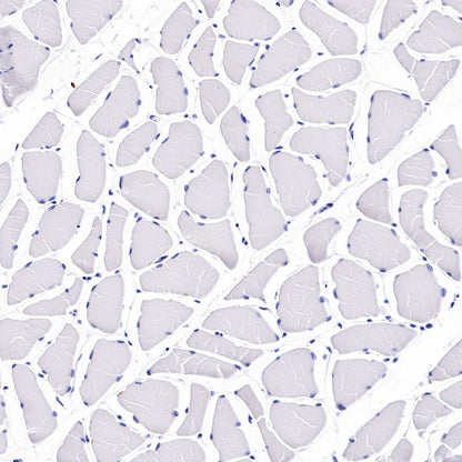 p14ARF Recombinant Rabbit mAb (S-R244)