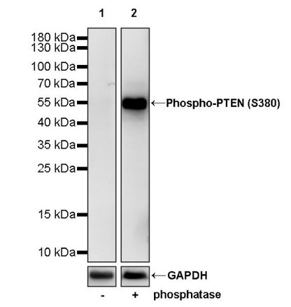 Phospho-PTEN (S380) Recombinant Rabbit mAb (S-1165-163)