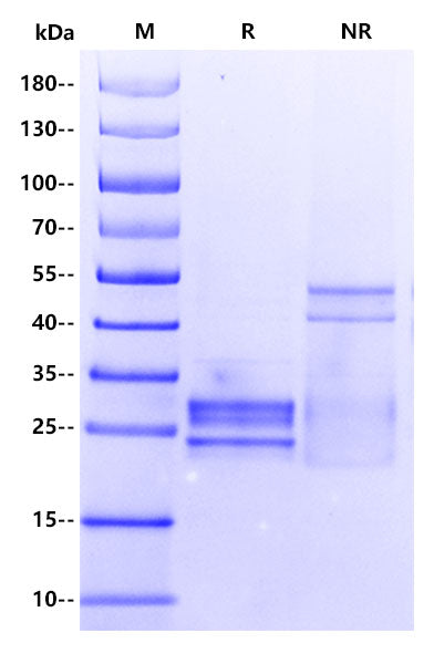 C1q Flag Tag Full Length Protein, Human