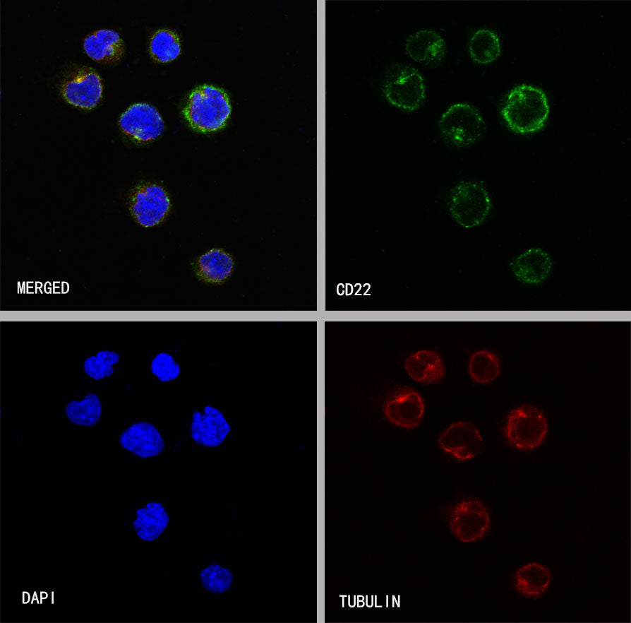 CD22 Recombinant Rabbit mAb (SDT-R113)
