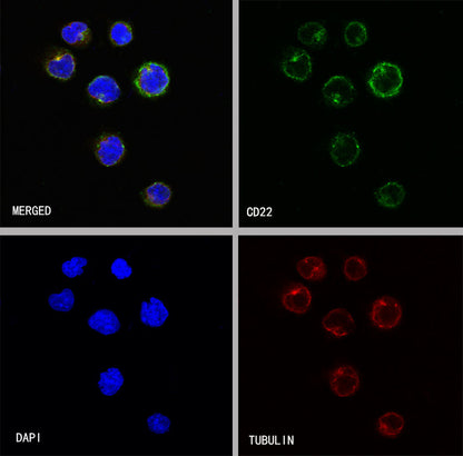 CD22 Recombinant Rabbit mAb (SDT-R113)