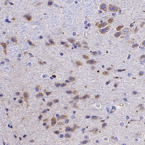 JAK1 Recombinant Rabbit mAb (S-1819-142)