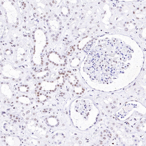 Caspase-8 Recombinant Rabbit mAb (S-2676-74)
