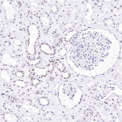 Caspase-8 Recombinant Rabbit mAb (S-2676-74)