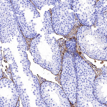 PDGFR alpha Recombinant Rabbit mAb (SDT-3353)