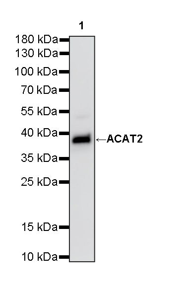 ACAT2 Recombinant Rabbit mAb