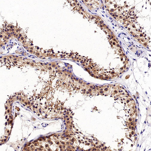 eIF4E Rabbit Polyclonal Antibody