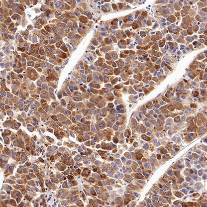 TGFBR2 Recombinant Rabbit mAb (S-1711-55)
