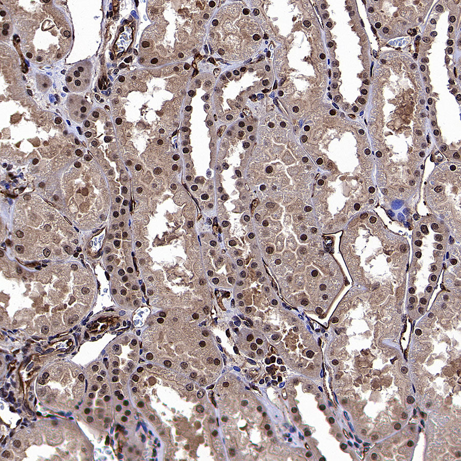 CNBP Recombinant Rabbit mAb (S-4288-3)