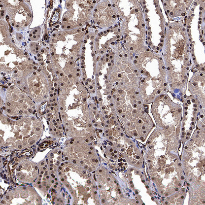 CNBP Recombinant Rabbit mAb (S-4288-3)