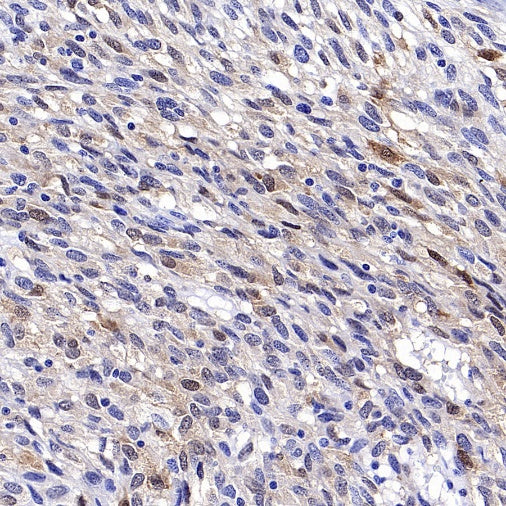 CA2 Rabbit Polyclonal Antibody