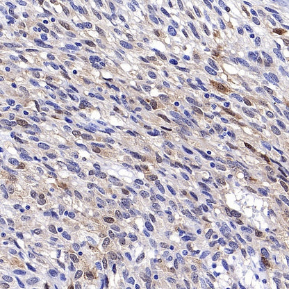 CA2 Rabbit Polyclonal Antibody