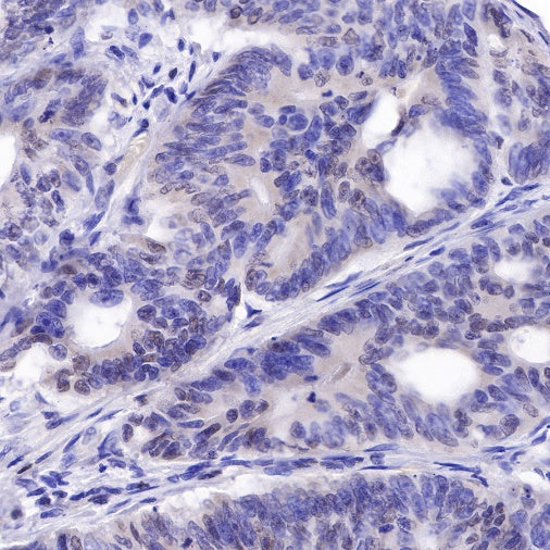 PMS2 Recombinant Rabbit mAb (SDT-111-307)