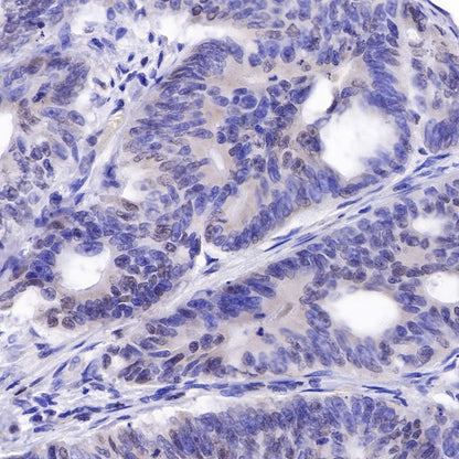 PMS2 Recombinant Rabbit mAb (SDT-111-307)