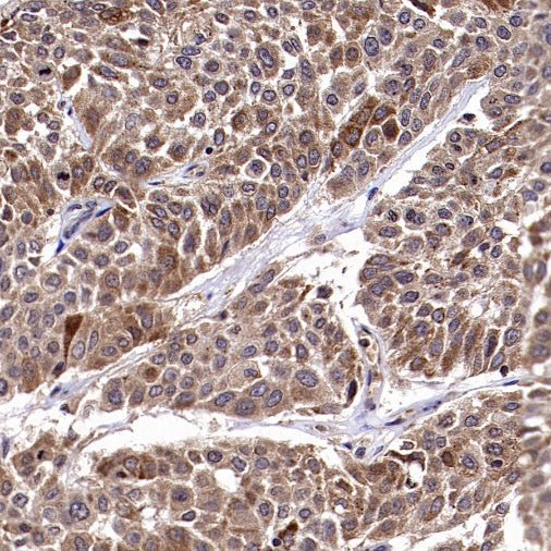 PTP1B Rabbit Polyclonal Antibody