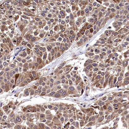 PTP1B Rabbit Polyclonal Antibody