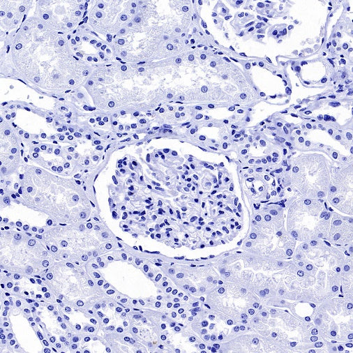 GFAP Recombinant Mouse mAb (SDT-3032)