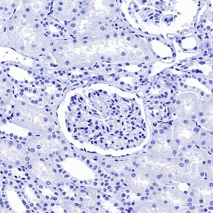 GFAP Recombinant Mouse mAb (SDT-3032)