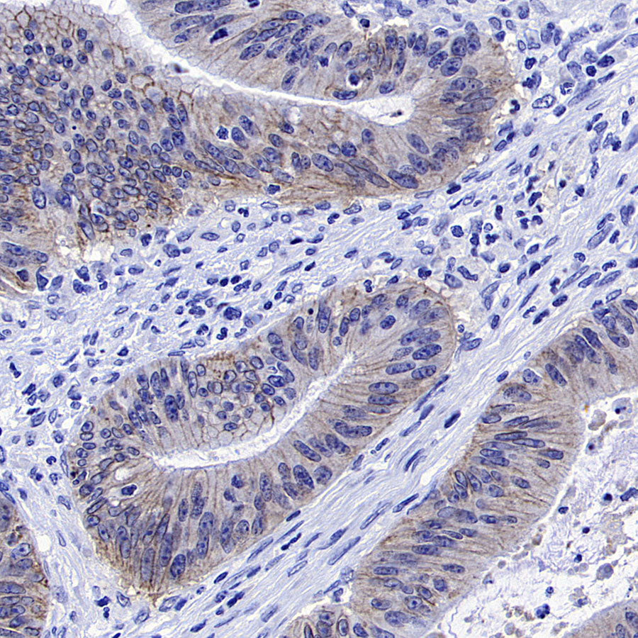 ATP1B1 Rabbit Polyclonal Antibody