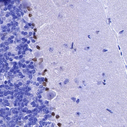 SOX1 Recombinant Rabbit mAb (S-R310)