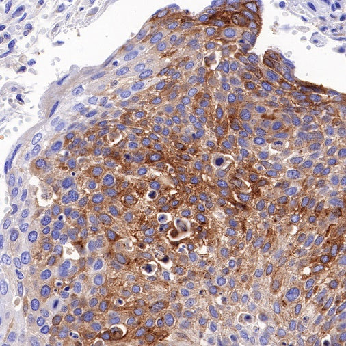 GPNMB Recombinant Rabbit mAb (S-491-6)