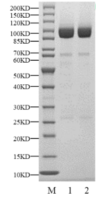PRKCD(PKCδ) GST Tag Protein, Human
