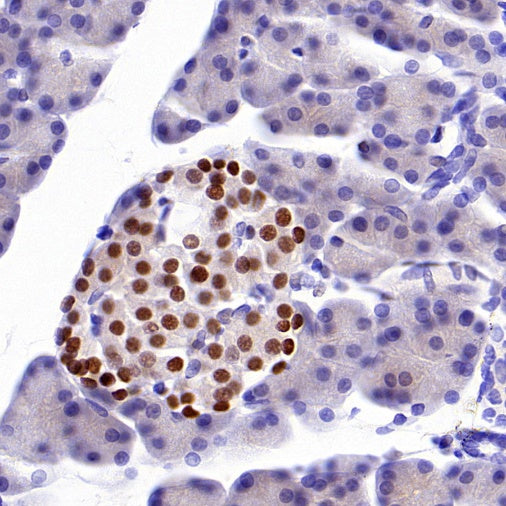 Islet1 Recombinant Rabbit mAb (SDT-2349-17)