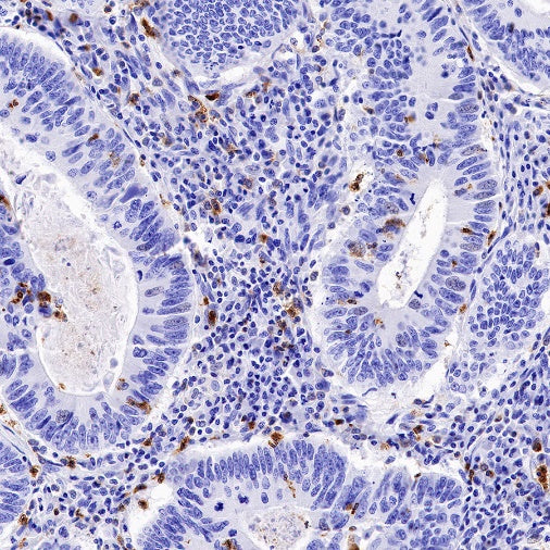 CXCR2 Recombinant Rabbit mAb (S-1292-30)