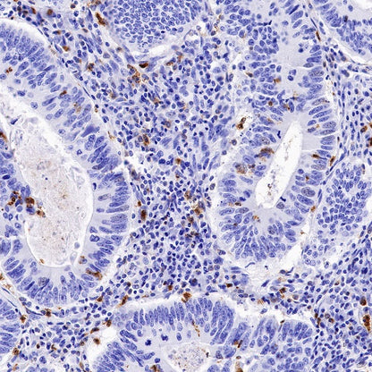 CXCR2 Recombinant Rabbit mAb (S-1292-30)