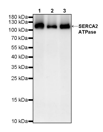 SERCA2 ATPase Recombinant Rabbit mAb (S-5956)