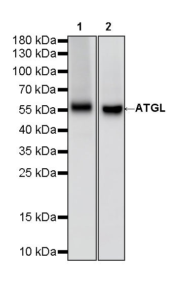 ATGL Recombinant Rabbit mAb (S-5284)