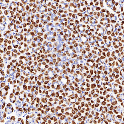 H+/K+-ATPase Recombinant Rabbit mAb (S-3474-110)