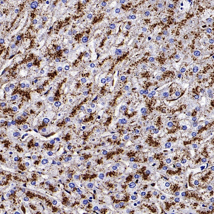 SCARB2/LIMPII Recombinant Rabbit mAb (S-2847-21)