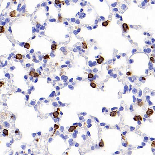 Prosurfactant Protein C Recombinant Rabbit mAb (S-1773-6)
