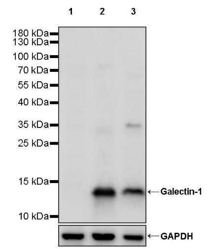 Galectin-1/LGALS1 Rabbit Polyclonal Antibody