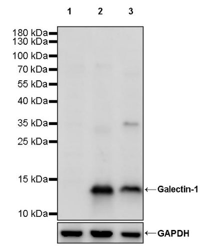 Galectin-1/LGALS1 Rabbit Polyclonal Antibody