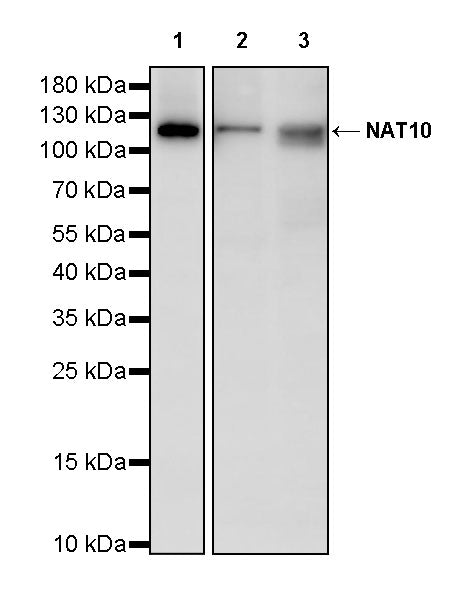 NAT10 Recombinant Rabbit mAb (S-2547-125)