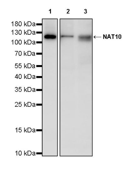 NAT10 Recombinant Rabbit mAb (S-2547-125)