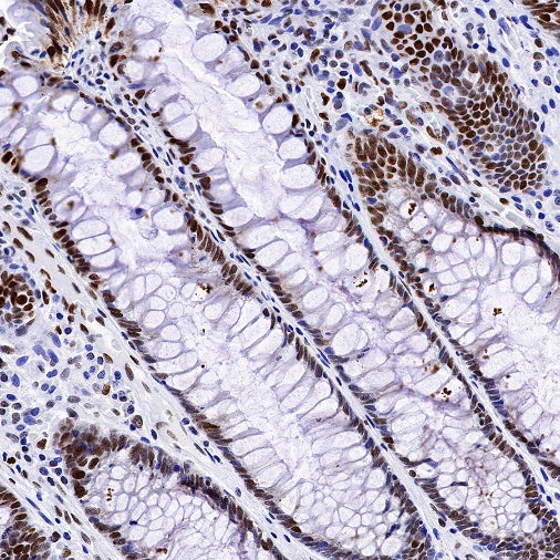 H2AFY Recombinant Rabbit mAb (S-1256-35)