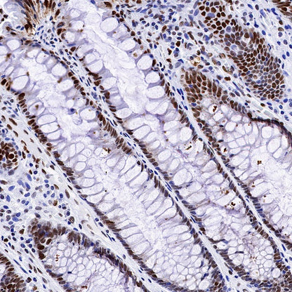 H2AFY Recombinant Rabbit mAb (S-1256-35)