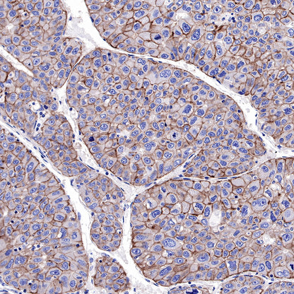 EGFR Recombinant Rabbit mAb (SDT-R110)