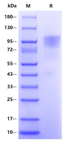 Mouse Tim-4 Protein, His Tag
