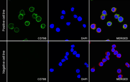 CD79B Recombinant Rabbit mAb(SDT-043-9)