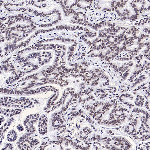 SF2 Recombinant Rabbit mAb (S-1845-27)
