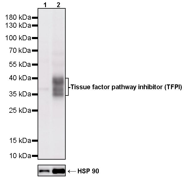 Tissue factor pathway inhibitor (TFPI) Recombinant Rabbit mAb (S-4436-30)
