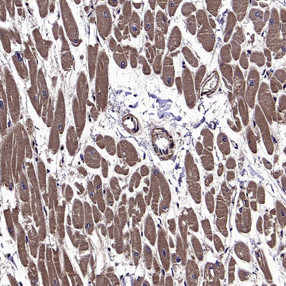 AGTR1 Recombinant Rabbit mAb (S-2447-22)
