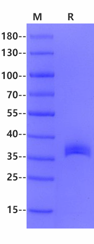DcR3 His Tag Protein, Human