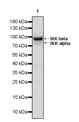 IKK alpha/beta Recombinant Rabbit mAb (S-1317-27)