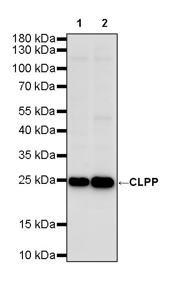 CLPP Recombinant Rabbit mAb (S-4169-31)